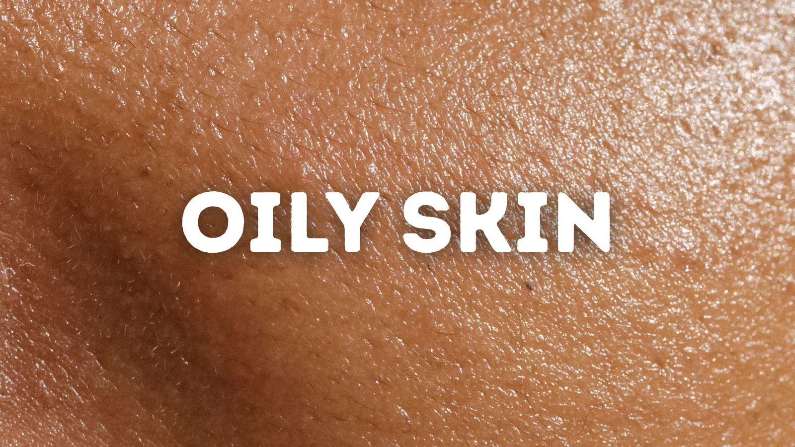 Oily Skin