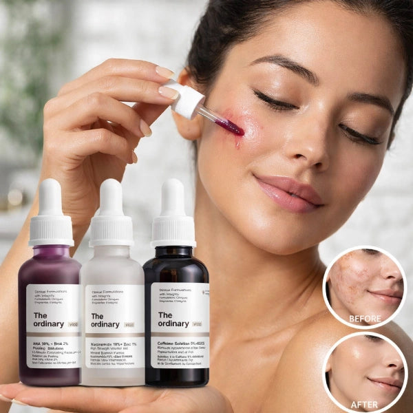 The Ordinary Vico 3-1 (30ml) Ultimate Results 100% Nature Skin Care TRIO